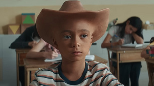 A fiú cowboykalap formájú fejjel született, nincsen könnyű élete