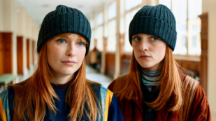 Genetikai betegség, ami majdnem tönkretette a bámulatos ikerpár karrierjét