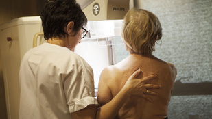 Kutatók tisztázták: Európában nem nálunk a legrosszabbak a rákhalálozási adatok