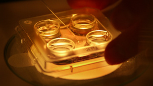 Mérföldkő az egészségügyben: eddig tiltott módszert engedélyeztek a meddőségkezelésben