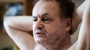 Galla Miklóst nem zavarja, ha belelátnak a végbélnyílásába, de az annál inkább, hogy visszatért a csuklása