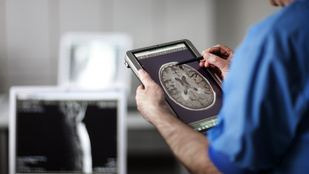 Egy sószemcsénél is kisebb kütyü hozhat áttörést az agykutatásban