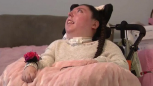 Születésekor halálra ítélték, ma már húszéves az agy nélkül született nő