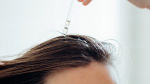 Reménykedhetnek a kopaszodók, egy új szérum hozhatja el a megváltást