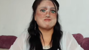 Minden nap újrarajzolja az arcát egy savtámadást túlélő nő